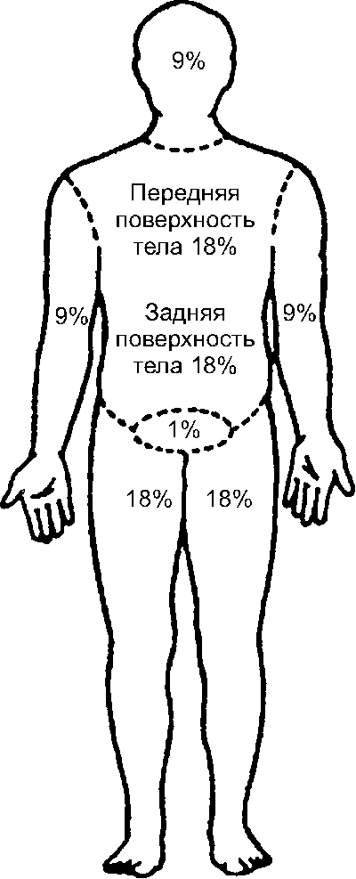 Правило девяток (метод А. Уоллеса)